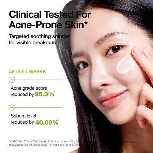 ANUA Azelaic Acid CICA Moisturizer - Lightweight Redness Relief for Acne-Prone Skin | Fragrance-Free, 3.38 fl oz