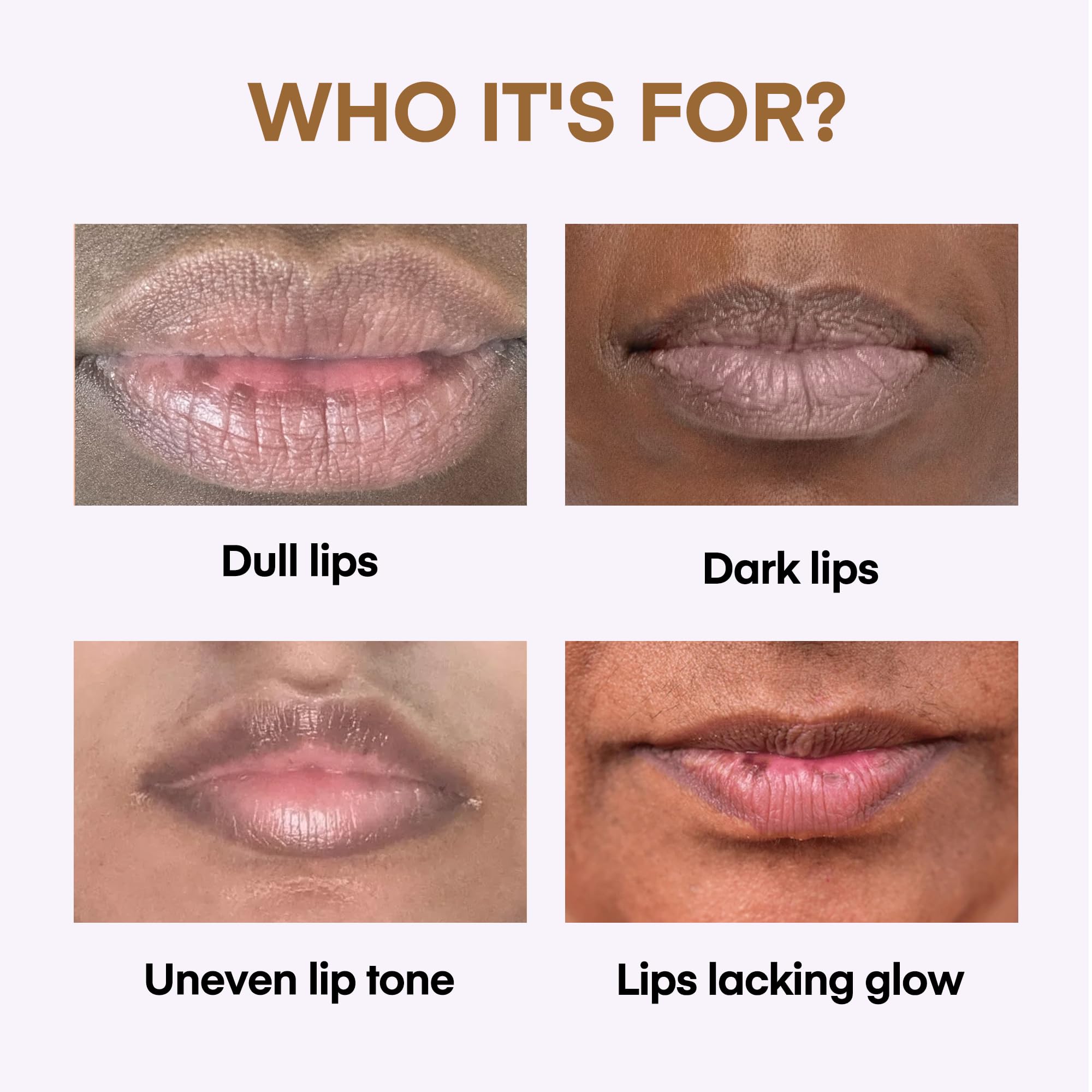 KissBea Lip Lightening for Dark Lips: for Smokers, Dry or Uneven-Toned Lips – Restores Natural Look & Moisture with VC, Lemon Peel & Licorice – Refreshing Vanilla Scent – 15 mL