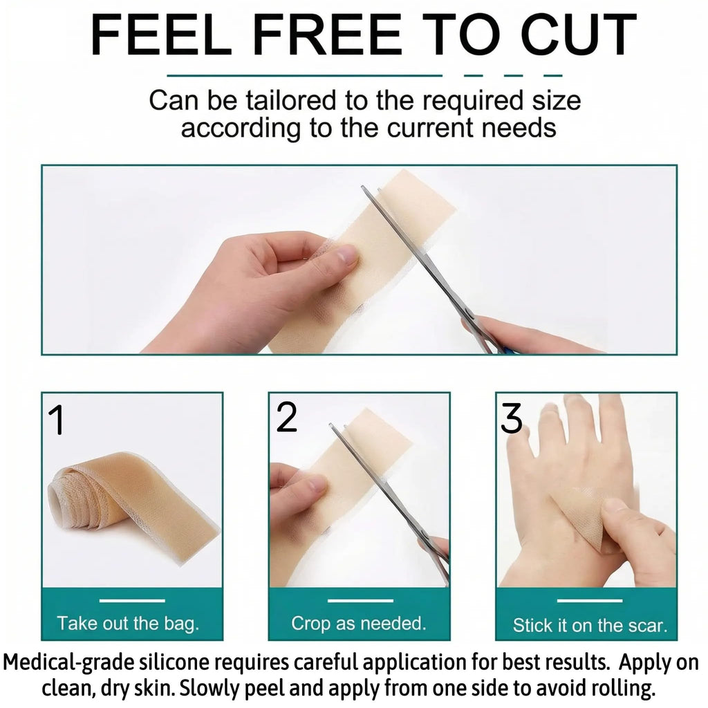 Silicone Scar Tape - Medical Grade Silicone Scar Sheets, 1.6" x 60" - 2 Pack - Professional Scar Removal Treatment for Keloid, C-Section, Surgery, Wrinkles - Reusable Scar Tape Strip