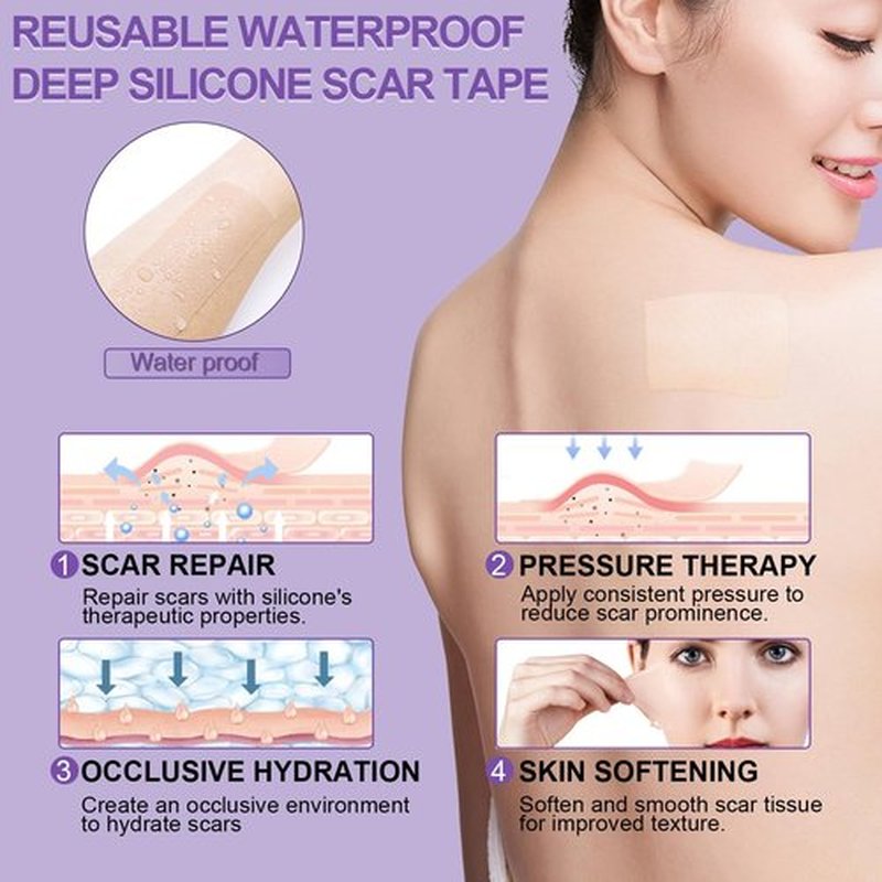 Silicone Scar Sheets, Medical Grade Silicone Scar Tape (1.6" x 60"), Professional Scar Removal Treatment, Reusable, for Healing Keloids, Surgeries Scars, C-sections, and Burns