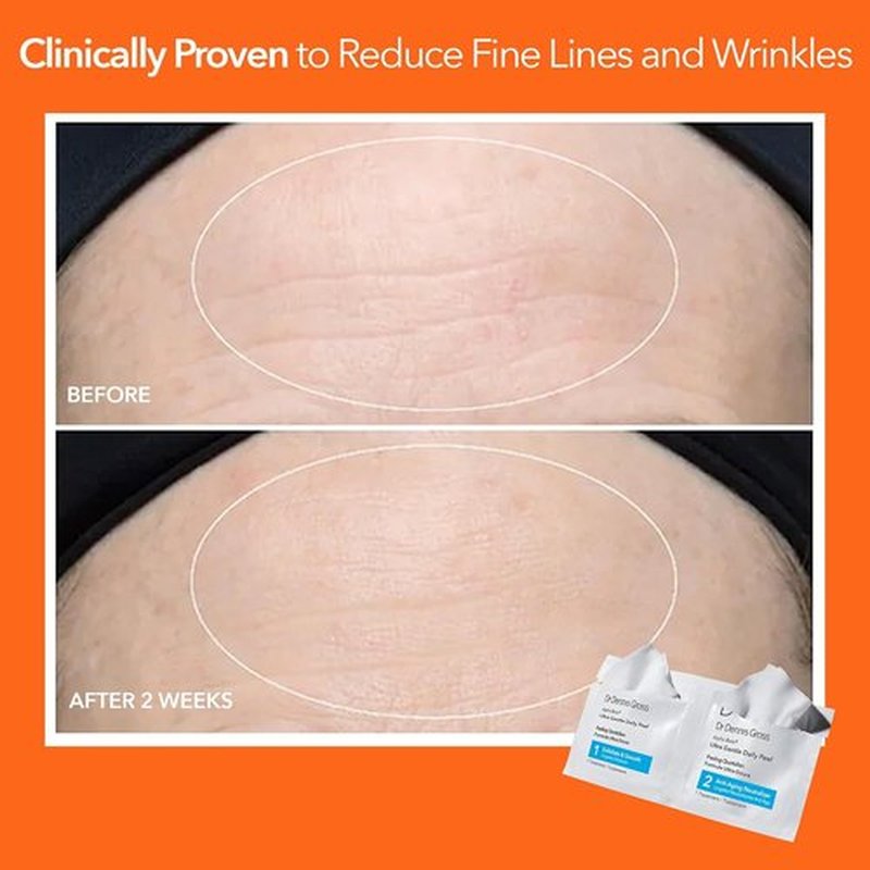Dr. Dennis Gross Alpha Beta Ultra Gentle Daily Peel - Hydrates Sensitive Skin & Smooths Texture | 30 Treatments