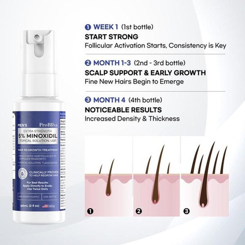 ProBliva 5% Minoxidil for Men Spray: Extra Strength 5% Minoxidil Topical Hair Growth Treatment - Clinically Proven Solution for Hair Loss & Thinning - Made in USA (2 Fl Oz (Pack of 1))