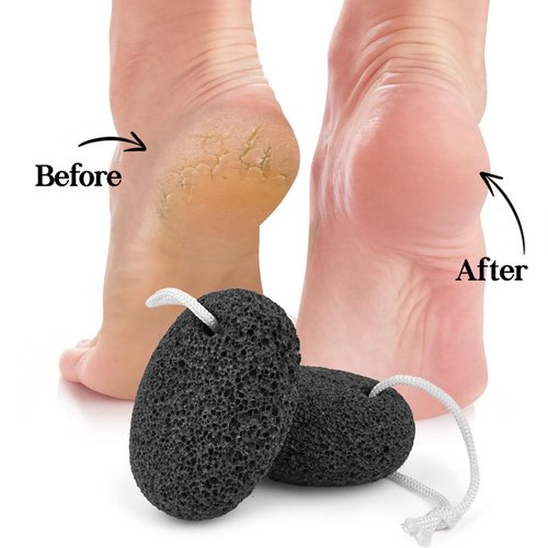 Natural Pumice Stone for Feet - Lava Foot Scrubber Dead Skin Corn Callus Remover Exfoliator Pedicure Tools for Feet Heels and Hands 2 Pack