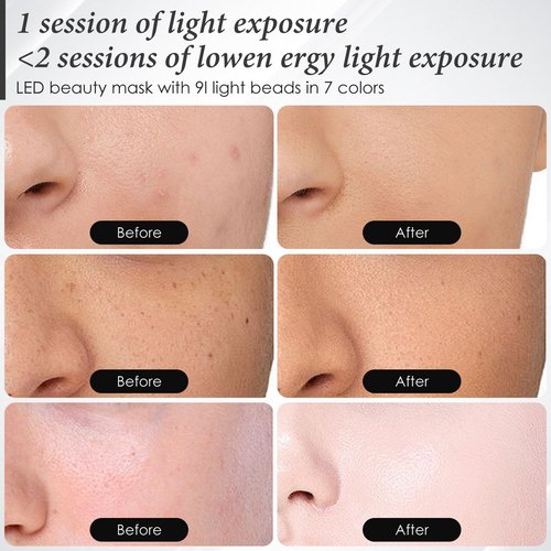 SDKWDH Red Light Mask for Face, 7-1 Colors Facial Care Mask, 850nm Infrared & Red Light Masks, Ergonomic Design for Home & Travel, Pink