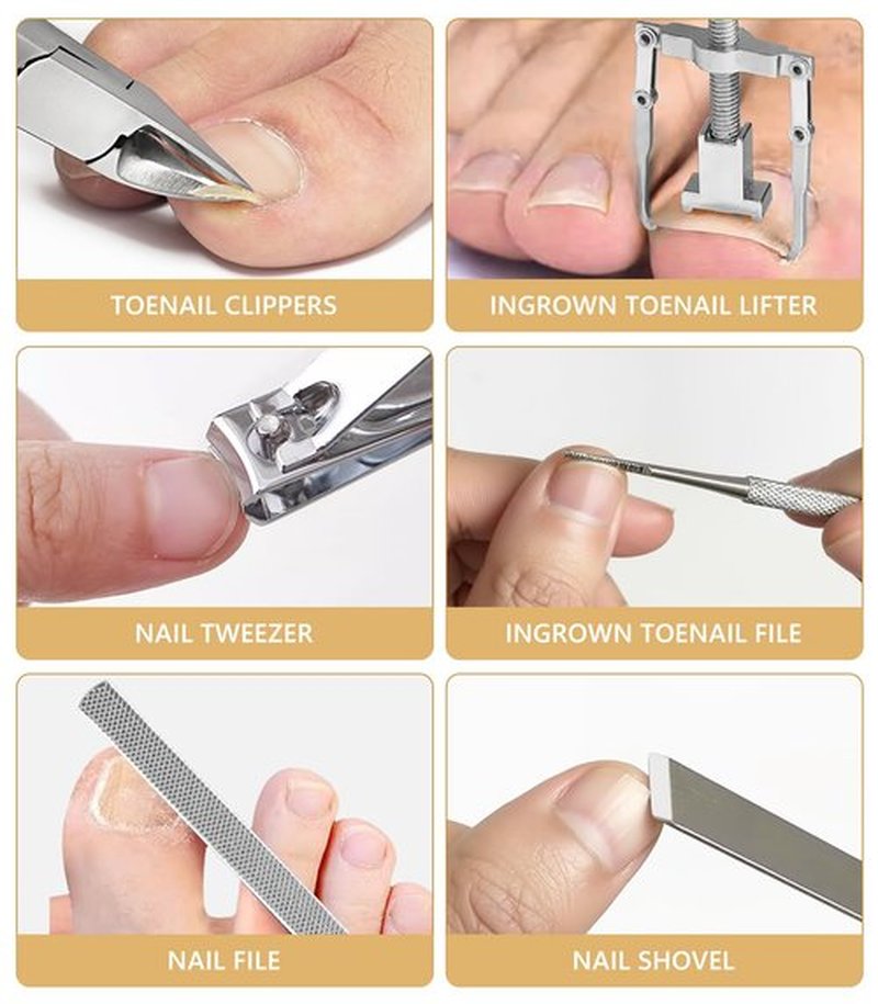 Ingrown Toenail Corrector Set with 50 Positive Nail Strips & 20 Breathable Patches, Professional Pedicure Tool Kit for Curved Toenails, Easy to Use for Beginners