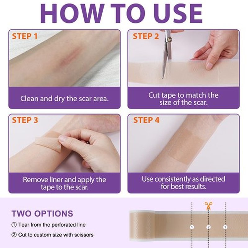 Silicone Scar Sheets, Silicone Sheets for Scars, Silicone Scar Tape for Surgical Scars, Medical Grade Scar Tape for Acne Scar Treatment, Stretch Marks, Tummy Tuck (1.6”x 60”), Roll-1.5M