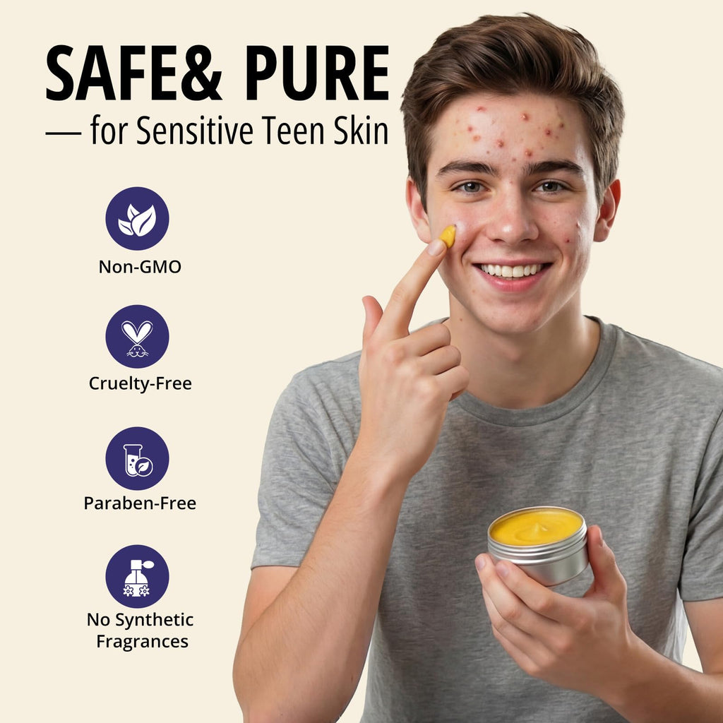 Bealions Organics Acne Killer Night Balm, 30g