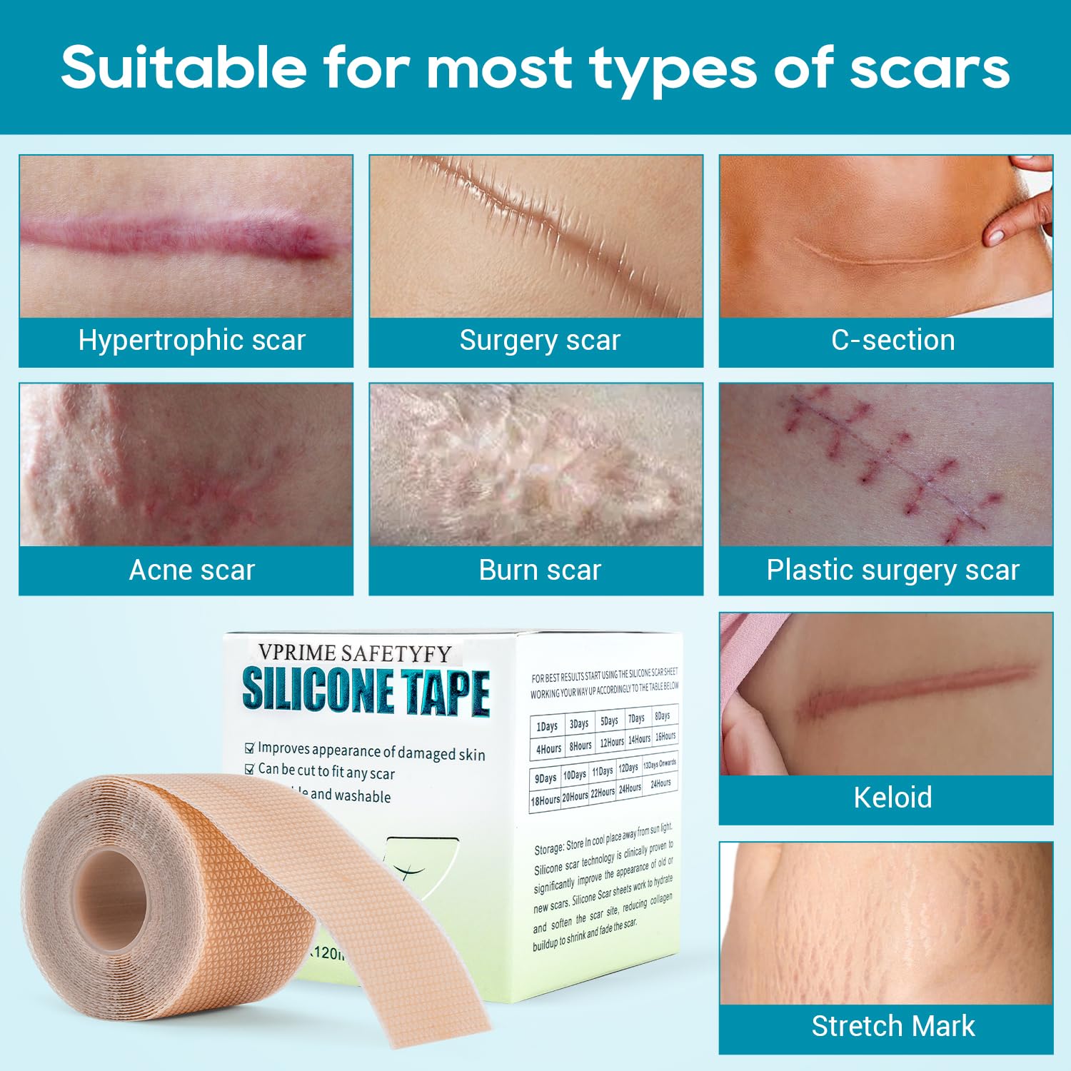 VPRIME SAFETYFY Silicone Scar Tape, Silicone Scar Sheets for Surgical Scars (1.6"x 80" Roll-2M), Medical Ggrade Scar Tape for Scars, Keloid, Acne Scars, Burn, C-Section, Stretch Marks Scars Away
