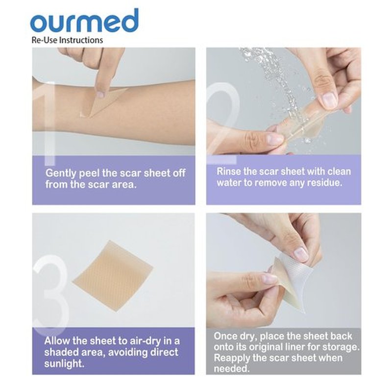 Ourmed Silicone Scar Removal Tape (1.6" x 120" Roll - 3M), Medical Grade Silicone Scar Removal Sheets, Hypoallergenic for New and Old Scars – Surgery, Burns, Acne, Keloids, Stretch Marks, C-Section