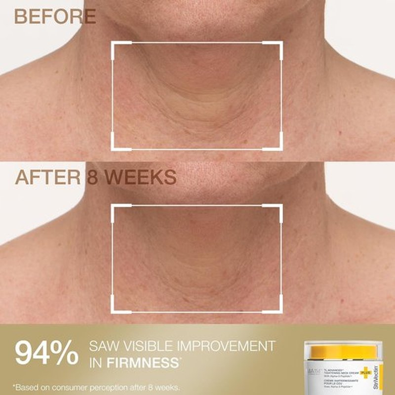 StriVectin Neck Cream & Serum Roller Set - Anti-Aging Formula for Smoother, Youthful Skin