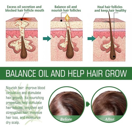 Aceite de Romero para Crecimiento y Tratamiento Capilar, Gotero para Estimular el Crecimiento del Cabello y Prevenir la Caída, 60ML/2.2 Fl Oz (2 Unidades)