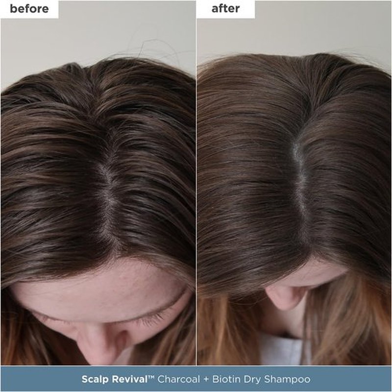 Briogeo Scalp Revival Essentials Set - Detox & Hydrate Your Scalp with Charcoal & Tea Tree | Vegan & Cruelty-Free