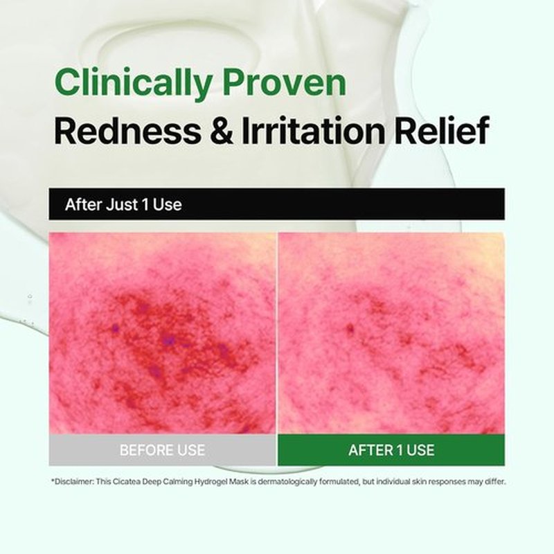 Cicatea Deep Calming Hydrogel Mask - Pore Minimizing & Hydrating with Centella Asiatica | 4 Pack (35g Each)