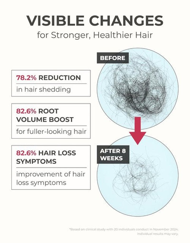 Motifull Hair Boosting Ampoule Tonic - Hair Growth Treatment for Thinning & Regrowth | Lightweight Scalp Serum (1.69 fl. oz.)