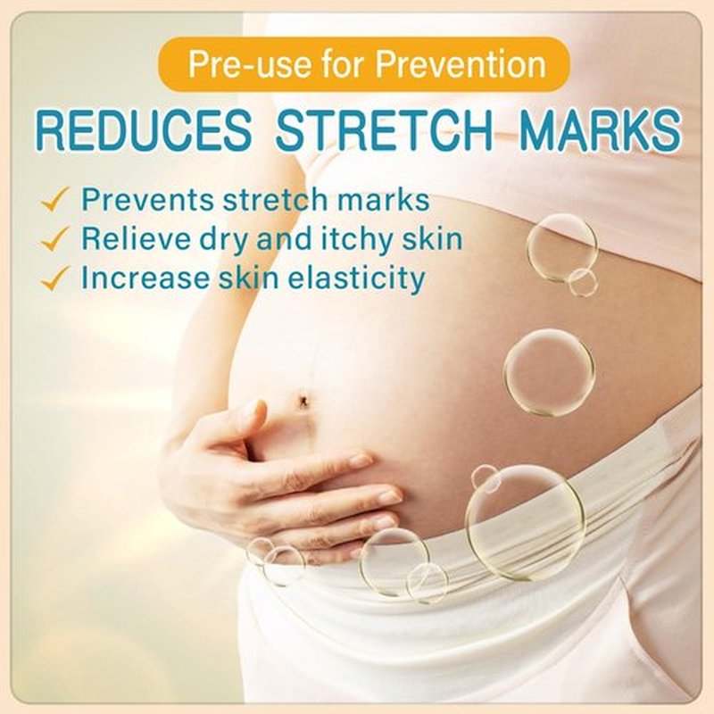 PEGO Stretch Mark Butter - Maternity Cream for Reducing Scars & Moisturizing Skin | 100g/3.53oz