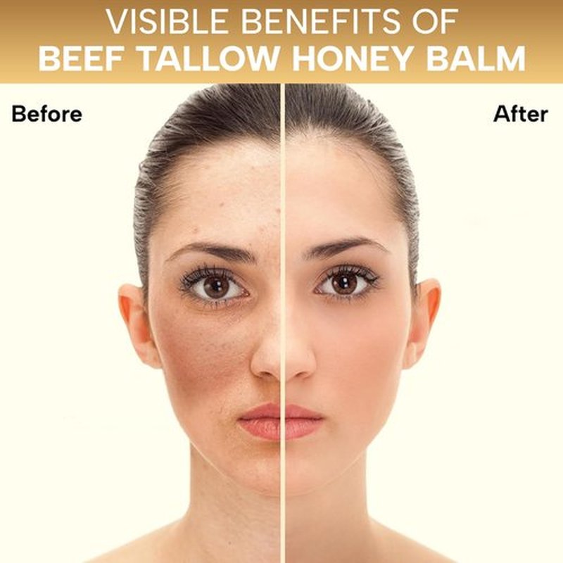 Dr. Miraculous 100% Grass-Fed Whipped Beef Tallow and Honey Balm for Skin, Moisturizer for Face & Body with Organic Beeswax & Organic Honey Balm, All Natural Formula, 4.23OZ (120G)