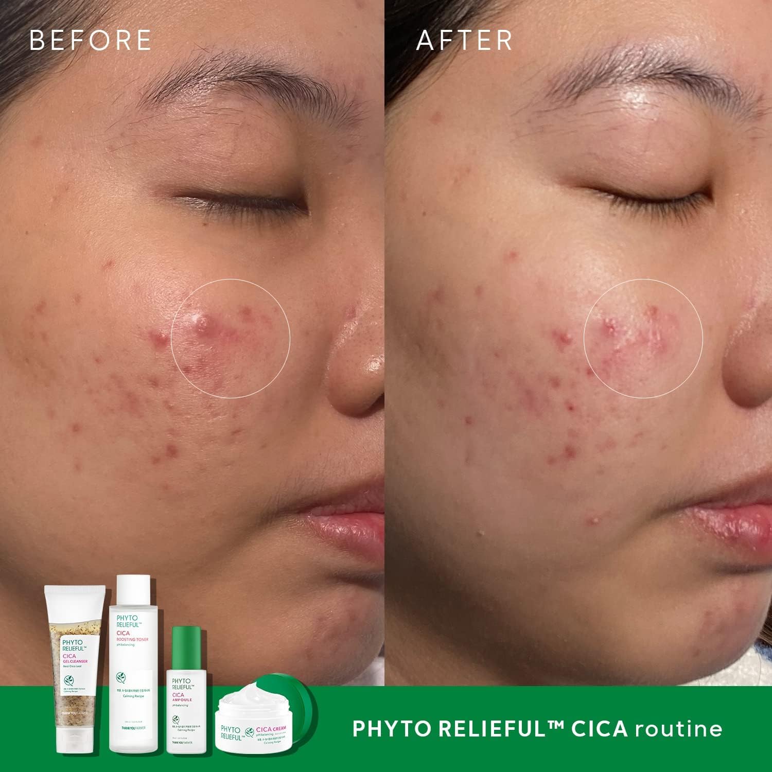 THANKYOU FARMER Phyto Relieful CICA PHA LHA Boosting Toner 7.03 fl oz (200ml), Dermatologist Tested, Alcohol-Free Liquid Exfoliant for Face, Oil-Free Hydrating Toner, Vegan, Fragrance-Free