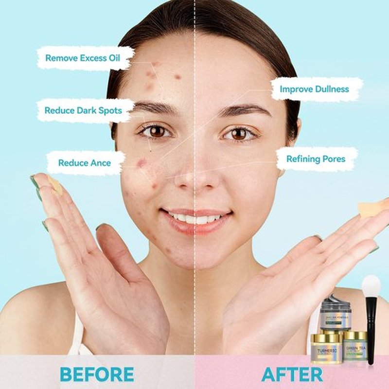 BOJICA 3PCS Clay Face Mask Skincare - Facial Skin Care Mask for Deep Pore Cleansing Turmeric Dead Sea Mud Green Tea Purifying and Hydrating - Reduce Acne Blackheads for Women and Men 2.5 OZ each