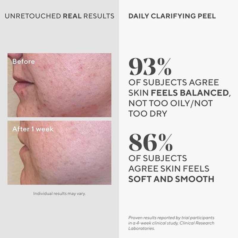 Murad Daily Clarifying Peel - AHA/BHA Exfoliating Liquid with Retinoid & Salicylic Acid for Smooth, Hydrated Skin - 3.2 Fl Oz