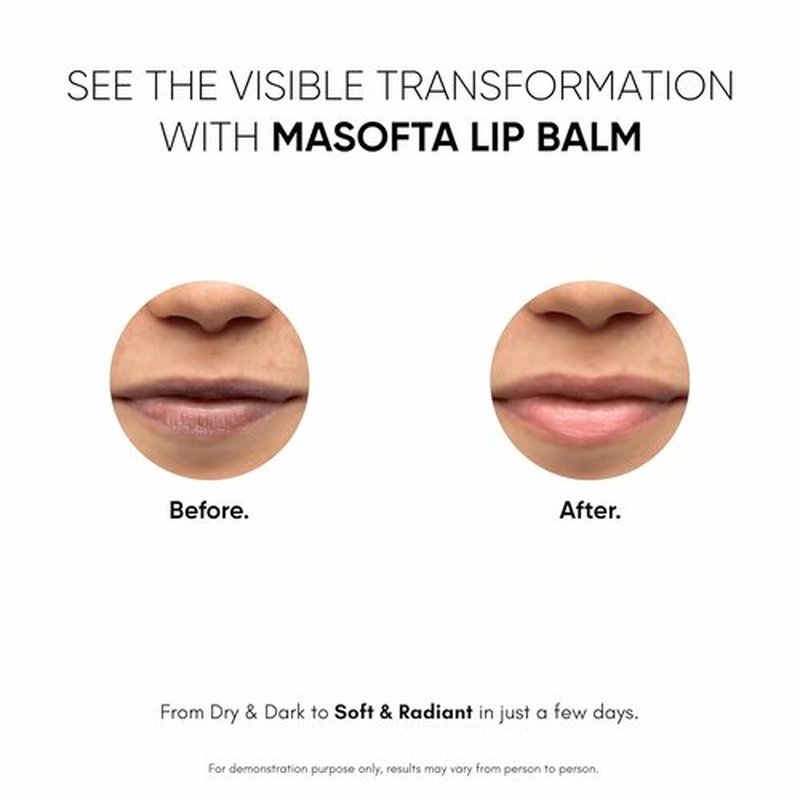 Masofta Shea Butter Lip Balm - Smooth, Clear Lips with Kojic Acid & SPF 30 | 0.52 oz (15g)