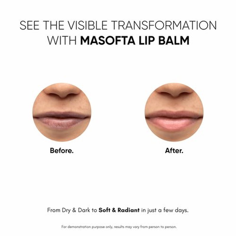 Masofta Shea Butter Lip Balm with Kojic Acid, Alpha Arbutin & Shea Butter for Smooth, Crack Free & Clear Lips, SPF 30 PA++, For Men & Women, 0.52 oz/15GMS