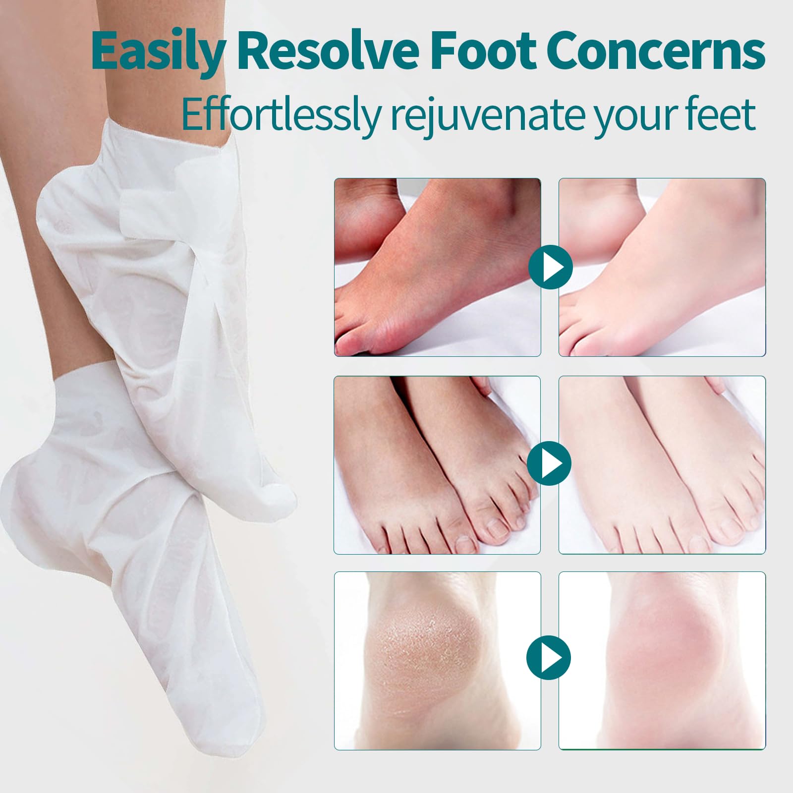 5 Pack Moisturizing Foot Mask,Hydrating Foot Masks for Dry Cracked Feet,Moisturizing Socks Dry Skin Moisturizer for Soft and Smooth Touch Feet,Foot Care Spa Gifts for Women Men Fathers Day Gift