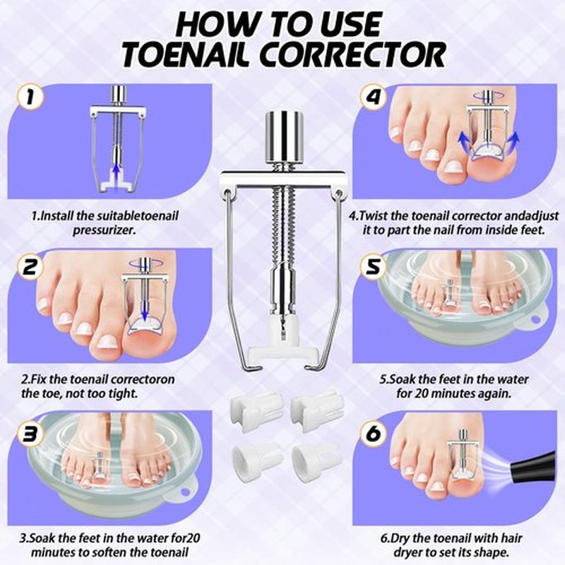 Ingrown Toenail Removal Kit, Ingrown Toenail Tool with Ingrown Toenail Strips, Curved Toenails Corrector Patch, Painless File and Lifter, Ingrown Nail Correction Home Care for Men and Women.