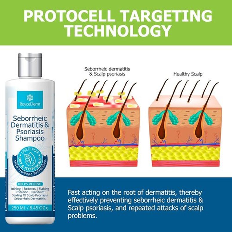 Roycederm Seborrheic Dermatitis & Psoriasis Shampoo - Relieves Itching, Flaking & Scaling for Dry Scalp