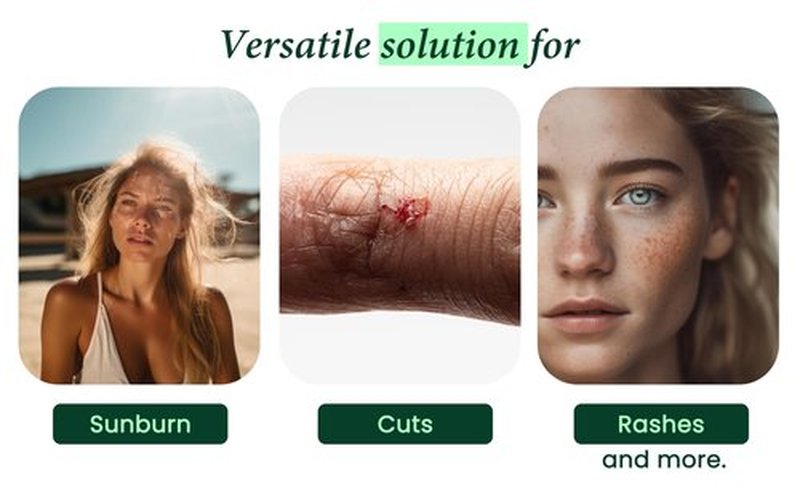 Allurials 99.75% Pure & Organic Aloe Vera Spray, Clinically tested & Dermatologist approved, Hydrates & Heals Dry & Damaged Skin & Hair- 12 Oz