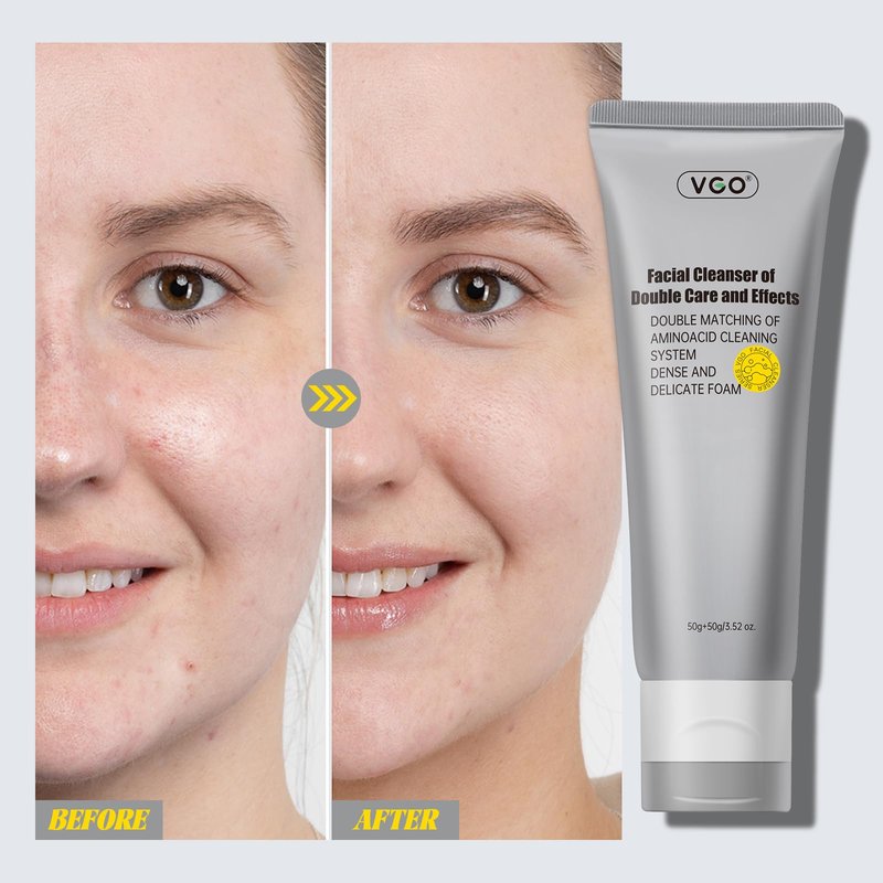 VGO Facial Cleanser, Daily Face Wash of Double Care and Effects, Cleansing Mud Mask & Amino Acid Cleansing All in One Gentle Face Cleanser, 3.52 Oz