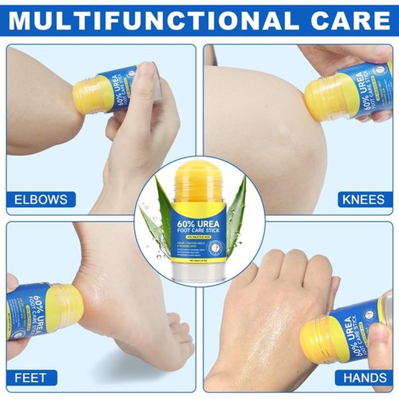 NBTREKTIE 60% Urea with 2% Salicylic Acid Foot Care Stick, Hydrating Repairs Feet Cream, Foot Lotion Moisturizer for Dry Cracked Feet, Elbows, Hands (1.41 Ounce (Pack of 1))