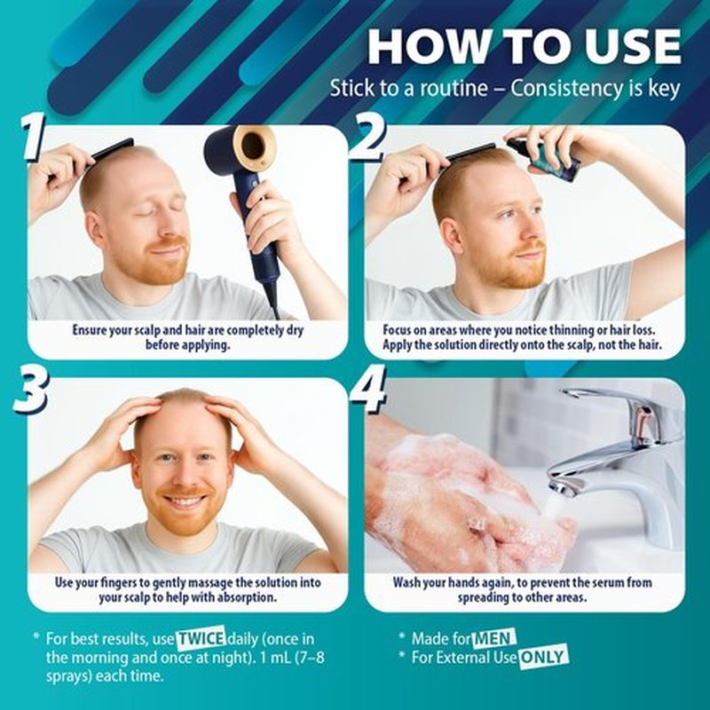 5% Minoxidil for Men Hair Growth: Hair and Beard Growth Oil Spary with Biotin, Ginger Extract, Lavender Oil – Hair Growth Serum & Hair Loss Treatment for Men