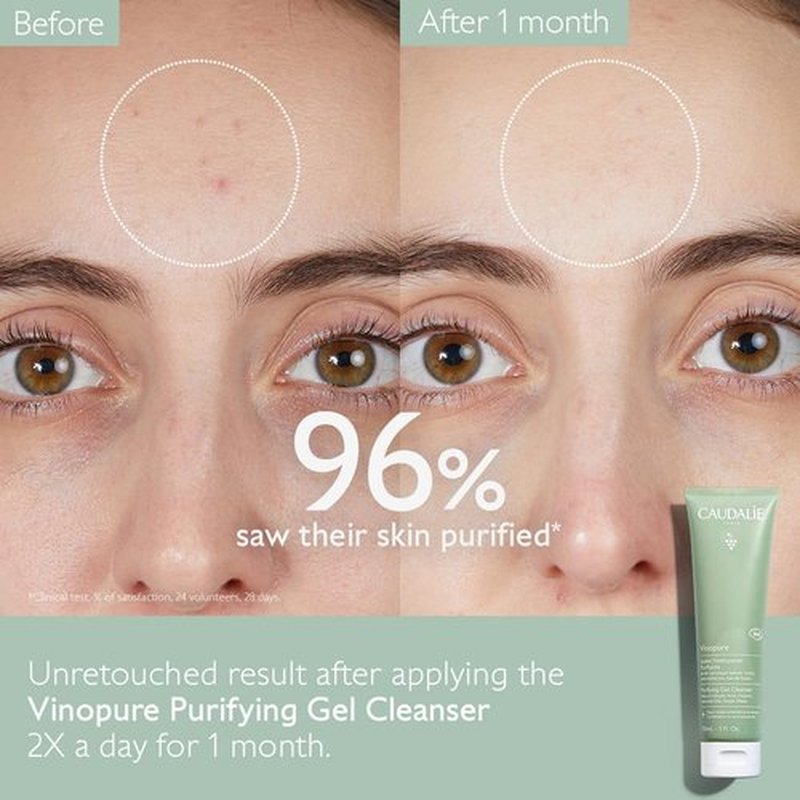 Caudalie Vinopure Salicylic Acid Cleanser - Pore Purifying Gel Formula | 150 mL