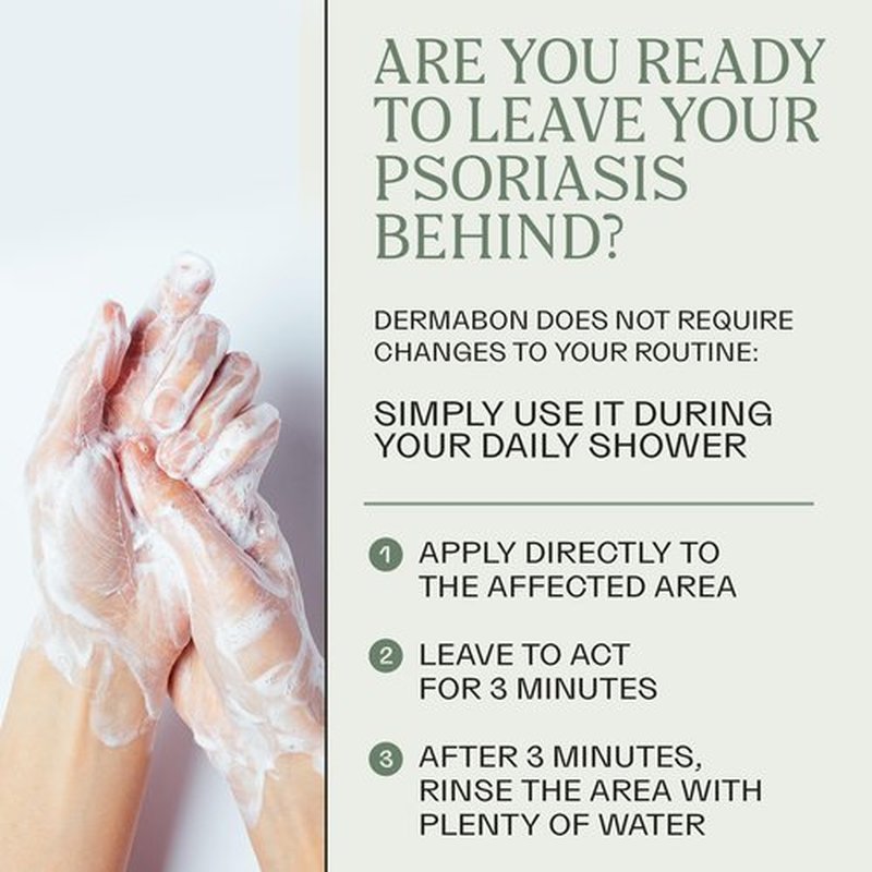 Dermabon Psoriasis, Dermatitis & Dandruff Control soap bar with 2% Coal Tar as its Active Ingredient - 1 Pack