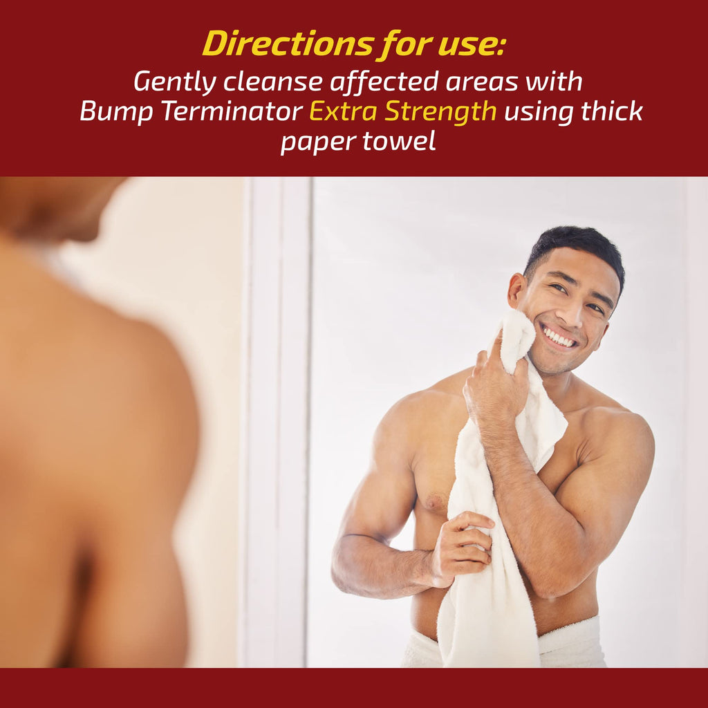 Bump Terminator Extra Strength Alcohol-Free Bumps Lotion, Razor Bump Treatment for Men & Women (4 Fluid Ounces)