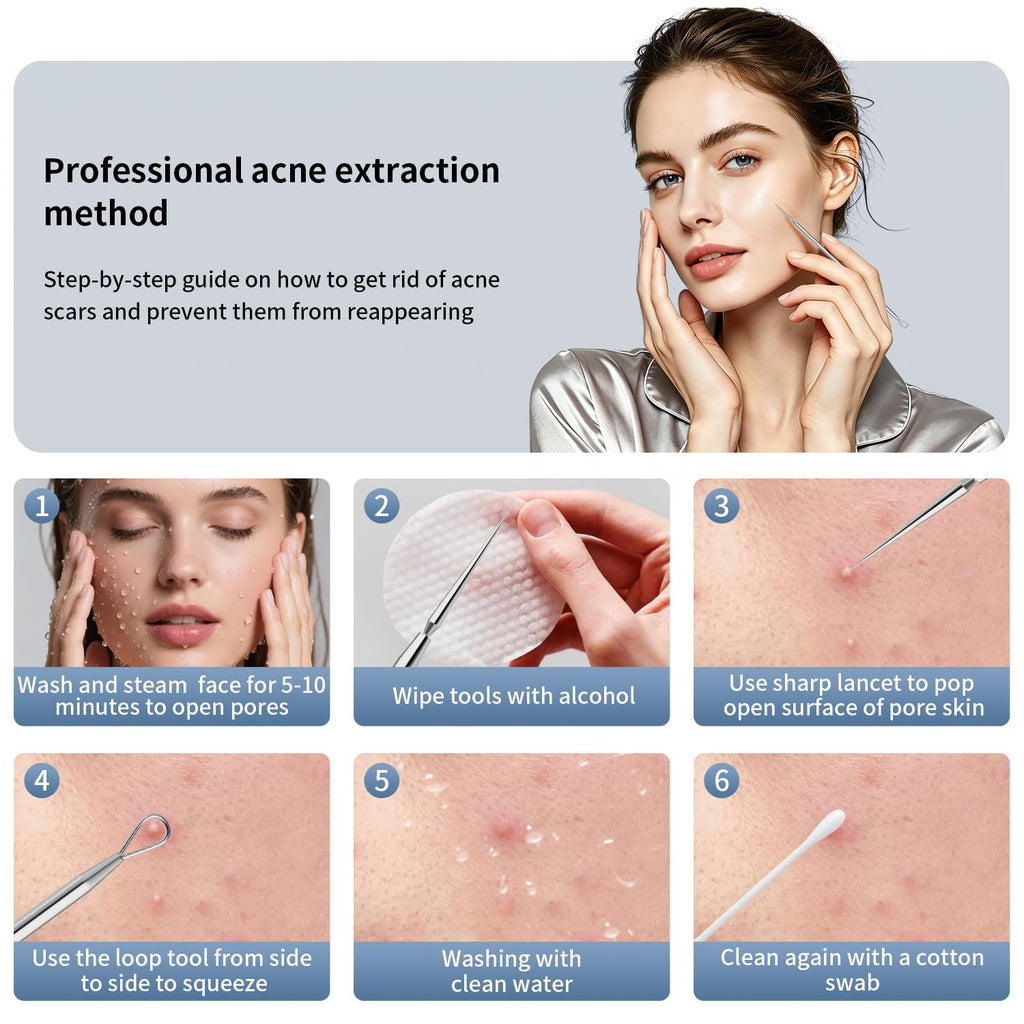 ZIZZON Titanium Lancet Needle Acne Blackhead Remover Pimple Extractor Popper Tool