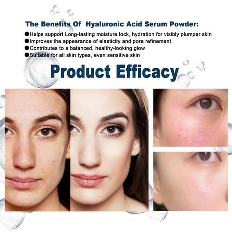 Pure Hyaluronic Acid Powder for Skin & Face (Sodium Hyaluronate) - Low Molecular Weight, Cosmetic Grade DIY Serum Ingredient for Deep Hydration, Acido Hialuronico en Polvo-Includes Scoop-60g(2.12oz)