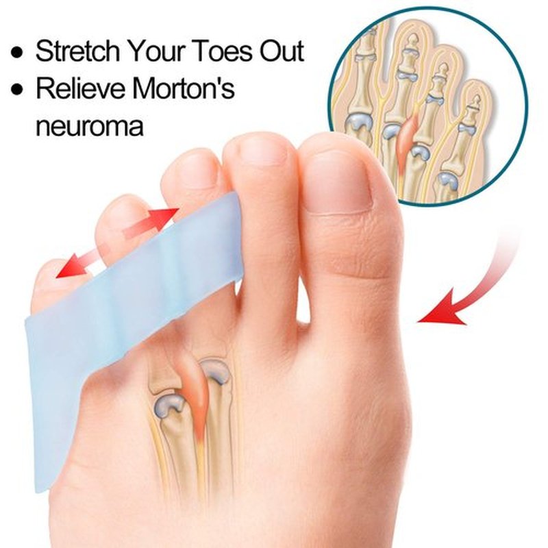Povihome 10 Pack Pinky Toe Separator and Protectors for Overlapping Toe, Curled Pinky Toes - Spacers for Morton's Neuroma Pain Relief