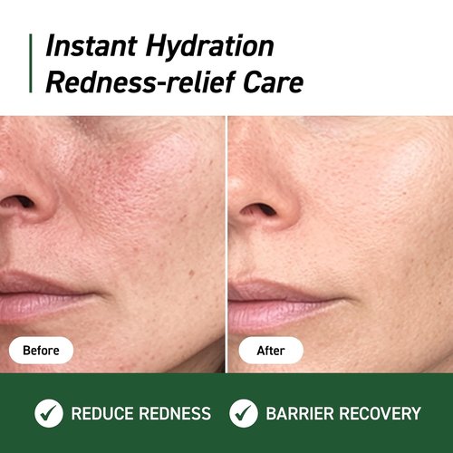 IVOSKIN Cica Redness Relief Treatment Cream - Soothing Green Moisturizer with Madecassoside for Sensitive Skin | Vegan Korean Skincare (1.76oz / 50g)