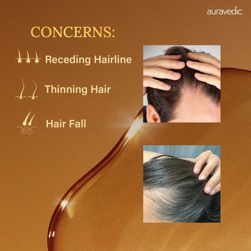 Auravedic Rosemary Hair Growth Oil with Moringa, Fenugreek & Brahmi | Scalp Nourishing Oil for Dry, Weak Hair & Breakage Care | Supports Fuller-Looking, Healthier Hair | 3.38 Fl Oz (100ml)