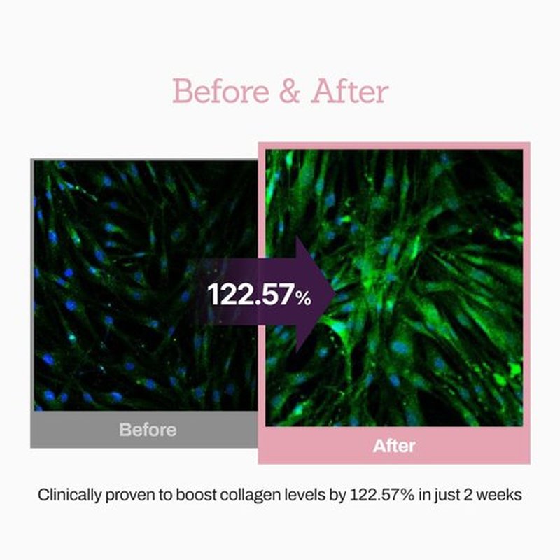 Collagen Peptide 12X Boosting Serum, Enhances Skin Elasticity & Reduces Deep Wrinkles, Promotes Collagen Production for Firm and Youthful Skin, Korean Skincare, 1.01 fl.oz