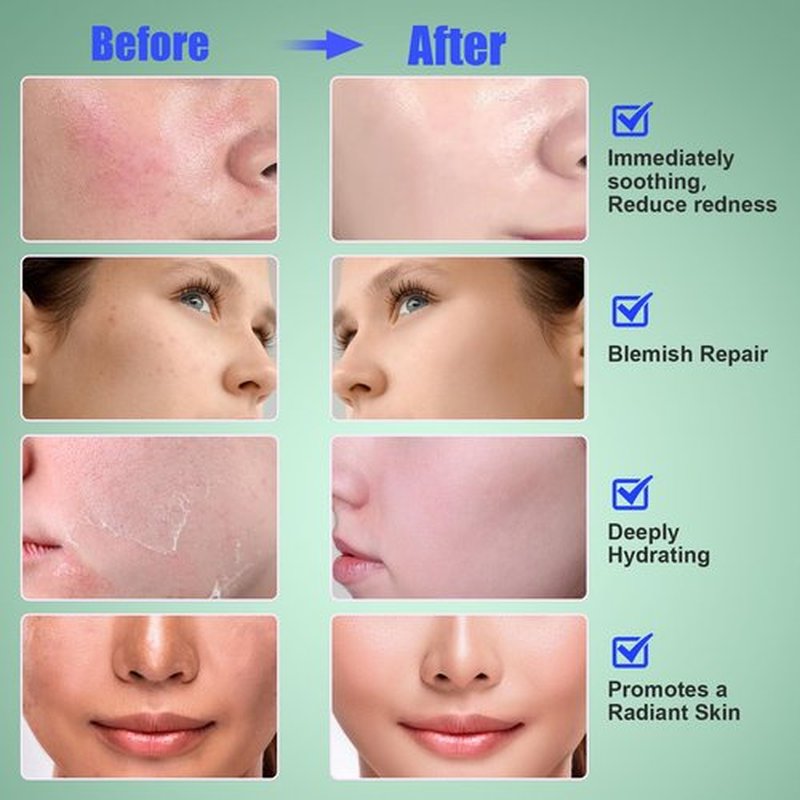 Madecassoside Toner Pads, Mild Exfoliating Pads, Calming Blemish Face Pad -Centella, Niacinamide, BHA Salicylic Acid for Soothe, Uneven Skin Tone, Dark Spots, Skincare 125 Pad