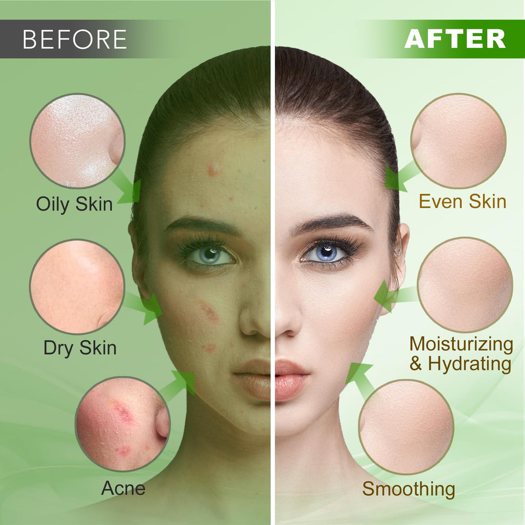 Angeland Jelly Mask for Facials Professional, Hydrating & Moisturizing Peel-Off Natural Gel Face Mask SkinCare, Professional Spa Use Jelly Face Masks, Deep Hydration & Glow 23 Fl Oz (Tea Tree)