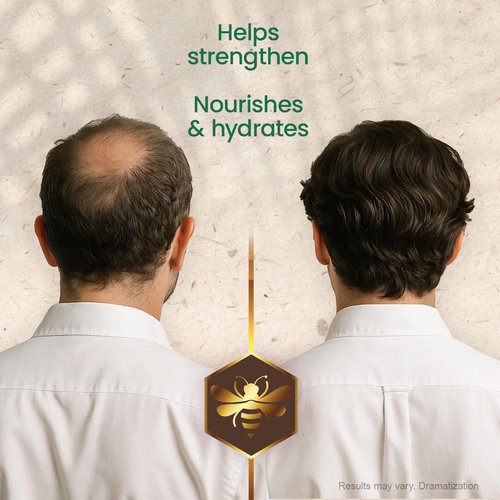 Tio Nacho Strengthening Shampoo - Anti Hair Loss & Breakage with Royal Jelly, Ginseng & Jojoba | 32 Fl Oz
