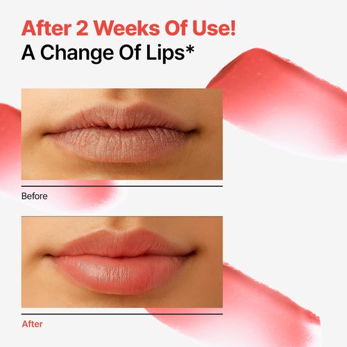 Dr.Different Retinal Lip Balm - Tinted Anti-Wrinkle Treatment with Deep Hydration | 0.14oz K-Skincare