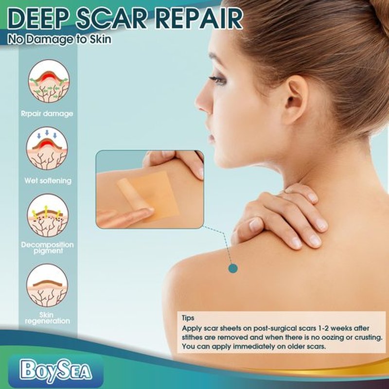 Boysea Silicone Scar Sheets (1.6" x 120") Clear Silicone Scar Tape - Scars Removal Treatment - Reusable Scar Strips for Keloid, C-Section, Burn, Surgical Scars
