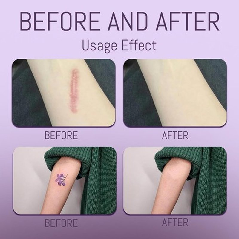 Regine Switzerland Body Coverage Perfector - Waterproof Makeup with Brush & Puff | Full Coverage for Tattoos & Scars (2.0oz Natural Beige)