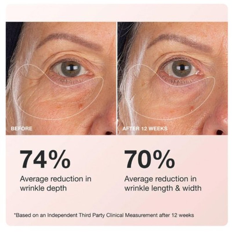 Innbeauty Project Eye Cream - Extreme Firming & Contouring with Peptides & Botanicals | 0.5 OZ (15ml)