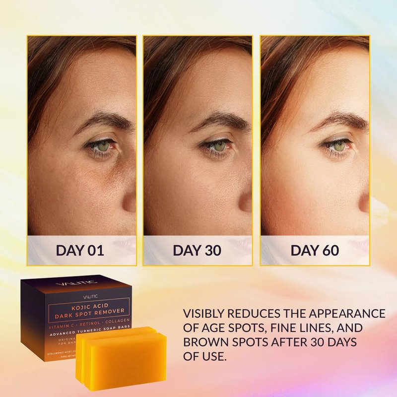 VALITIC Kojic Acid Dark Spot Remover Soap Bars - Infused with Vitamin C, Retinol & Turmeric | 2 Pack