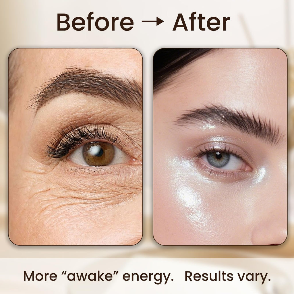 ZZILME Under Eye Balm Stick with Retinol and Caffeine, Hydrating Eye Cream Brightener for Dark Circles, Puffiness, Fine Lines and Wrinkles, Portable Balm Stick for On-the-Go Daily Eye Care 15 ml